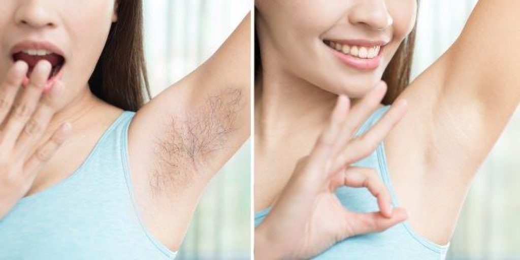 Benefits of Using an Electric Shaver for Armpit Hair Removal